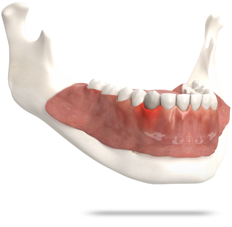 Zahnarzt Hannover, Zahn- und Implantat-Zentrum  